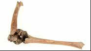 Fratura femoral analisada em estudo - Divulgação/Museu Cultural de Lund/Nelly Hercberg